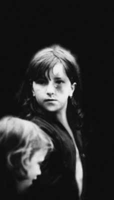 SC163 Battered Child Stepney 1958